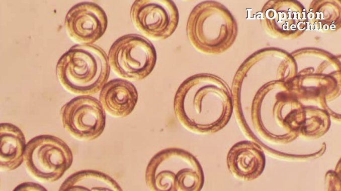 Trichinella spiralis