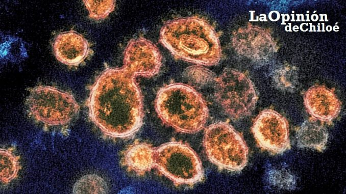 National Institute of Allergy and Infectious Diseases - Rocky Mountain Laboratories shows SARS-CoV-2